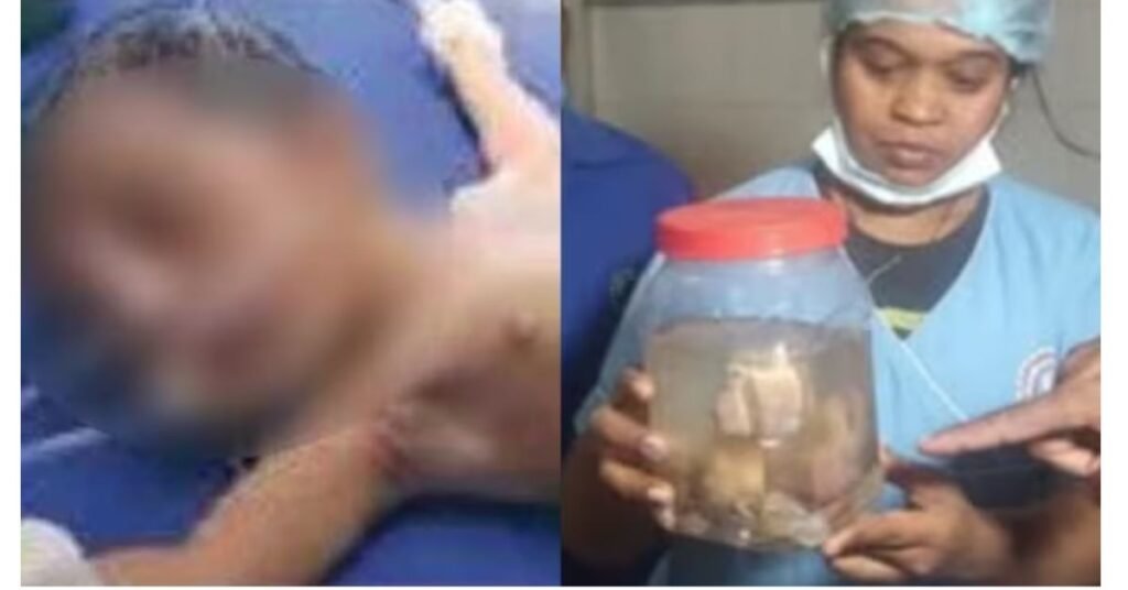 Another baby was seen inside the belly of the baby