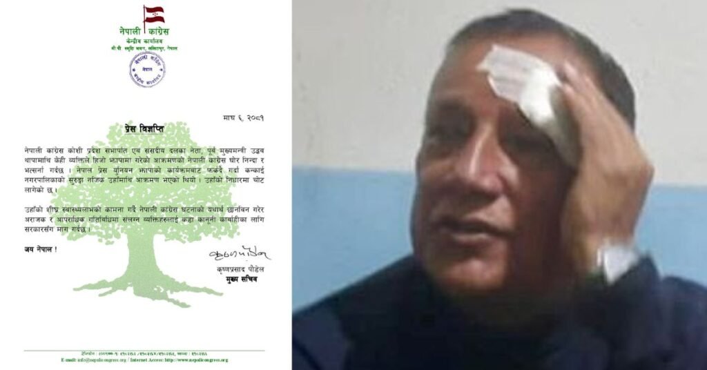 Nepali Congress condemns the attack on former Chief Minister Uddhav Thapa demands strict action